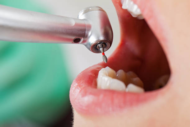 Best Cracked Tooth Emergency Dentist  in Trenton, MI